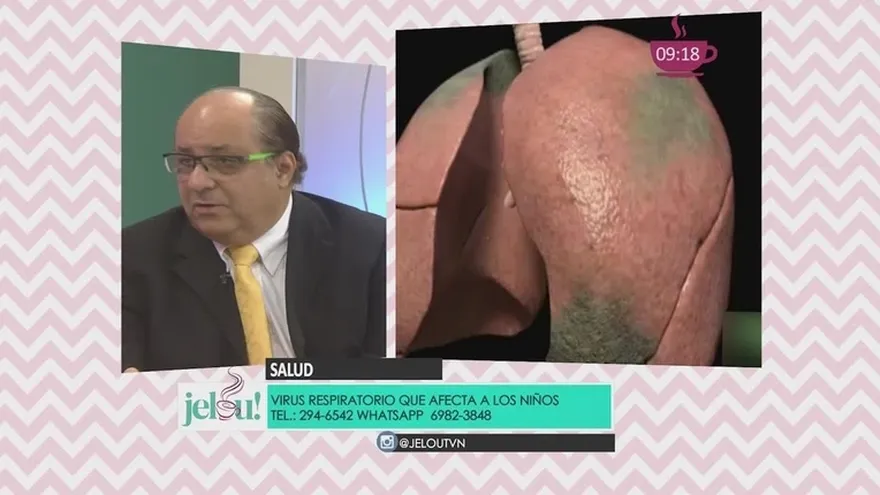 Lo que debes saber ante un cuadro respiratorio en niños