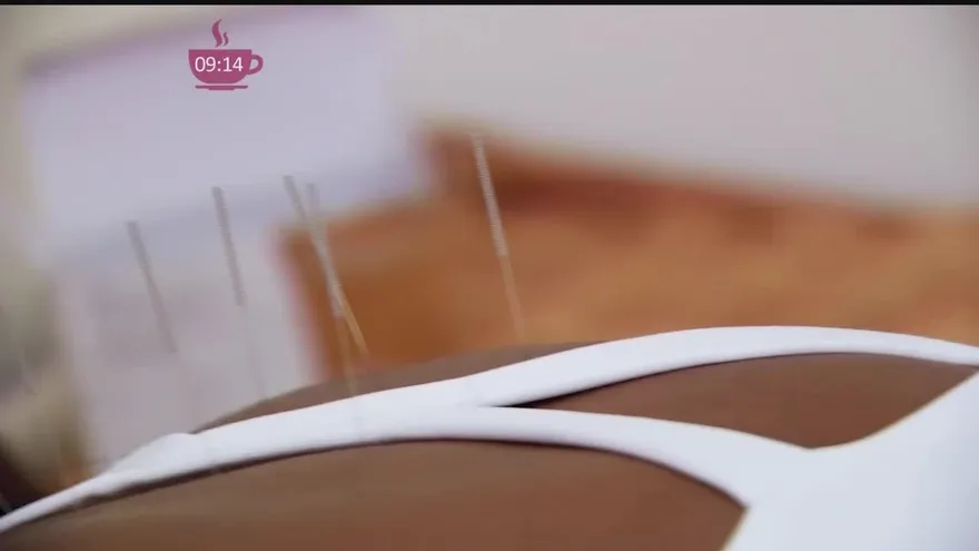 Conozcamos sobre la acupuntura en el Centro de terapia orientales