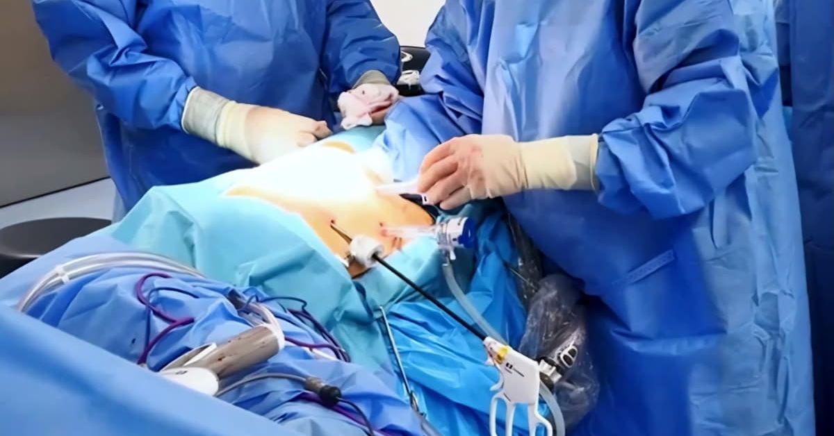 CSS activa plan con formación local y reclutamiento internacional para enfrentar déficit de especialistas