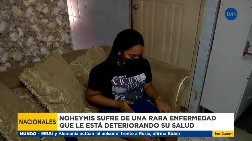 Noheymis pide ayuda para no perder la vista