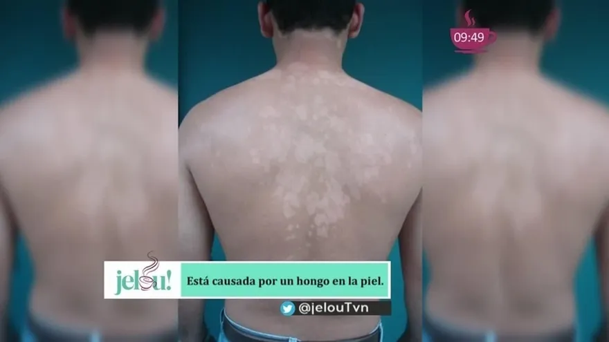 Tienes paño blanco y no sabes qué hacer