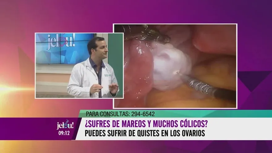 ¡Quistes en el ovario! ¿Qué hacer para eliminarlos?