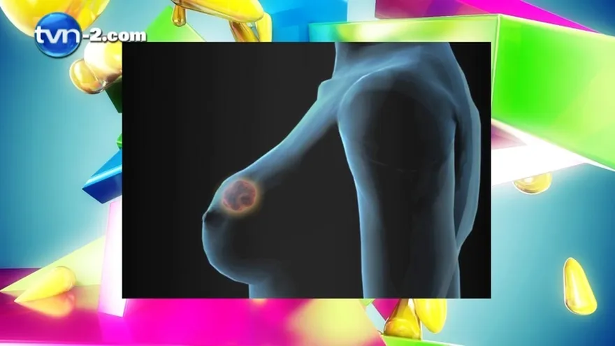 Segmento Salud al Día "Cáncer de mama y ovarios,su diagnostico actual y terapia