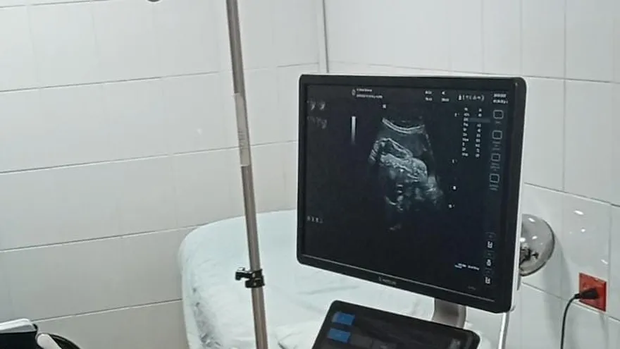 Sala de ultrasonidos