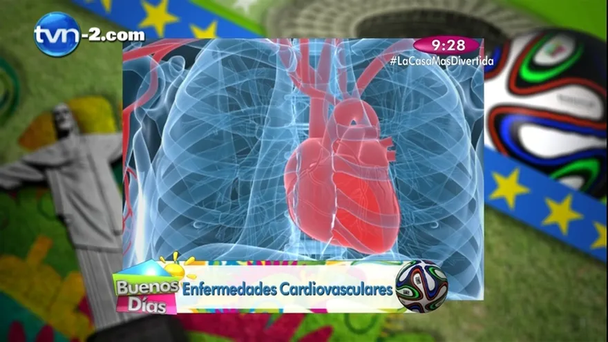 Segmento Salud al Día - Enfermedades Cardiovasculares