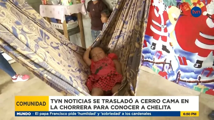 Chelita, una niña que presenta una enfermedad en la piel