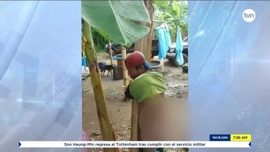 Denuncian golpiza a joven en una finca en Bocas del Toro