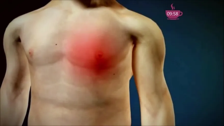 La actividad física es vital para evitar Infartos.