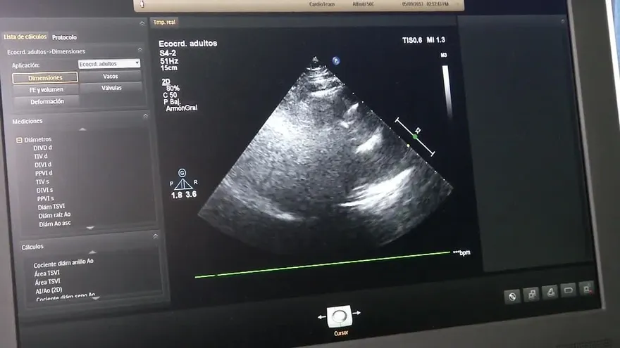 Médicos advierten sobre las fallas cardíacas