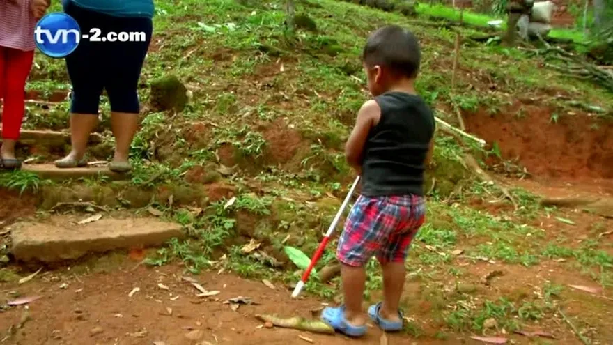 Madre de niño de 2 años con ceguera pide apoyo económico