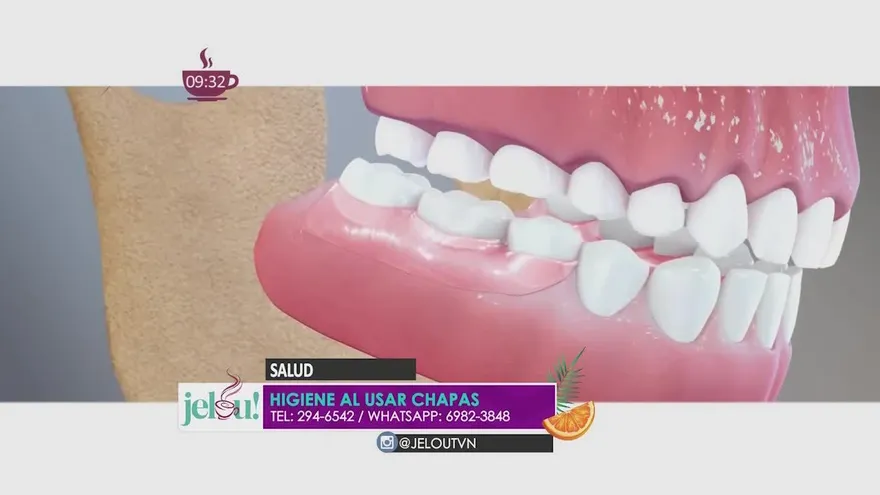 Cómo cuidar tus prótesis dentales o chapas