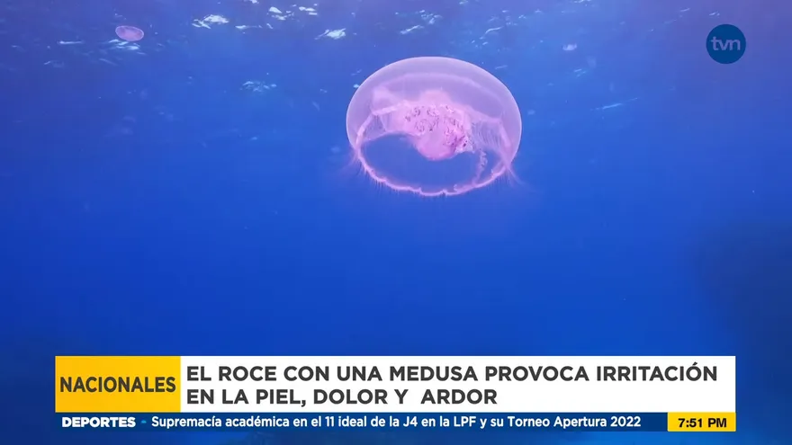 ¿Qué hacer si es tocado por tentáculos de las aguas malas?