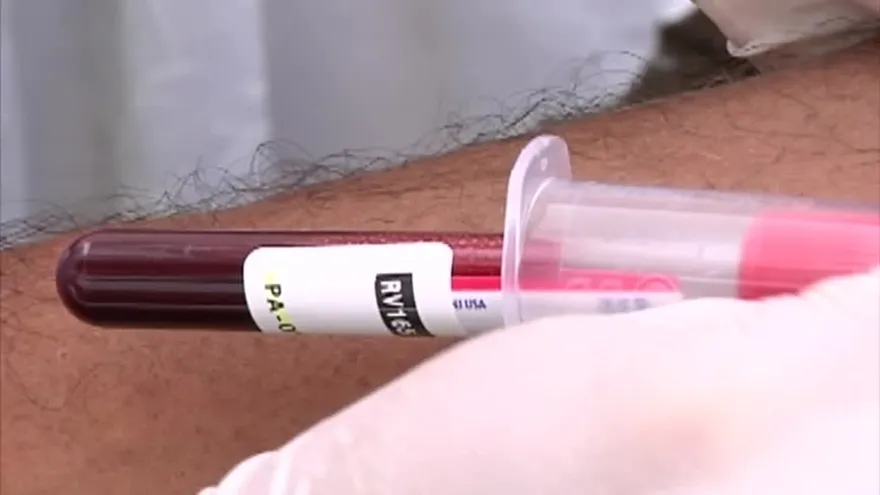 Estrategias de acción contra el VIH