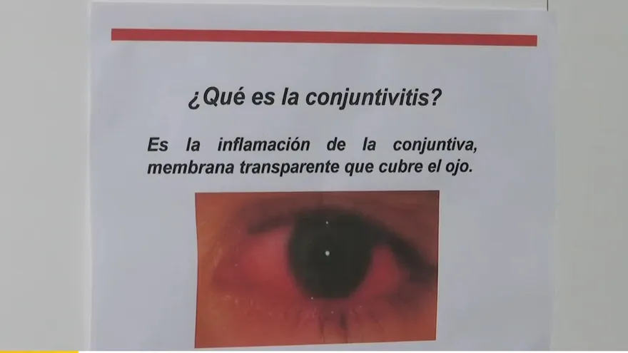 Aumentan los casos de conjuntivitis infantil