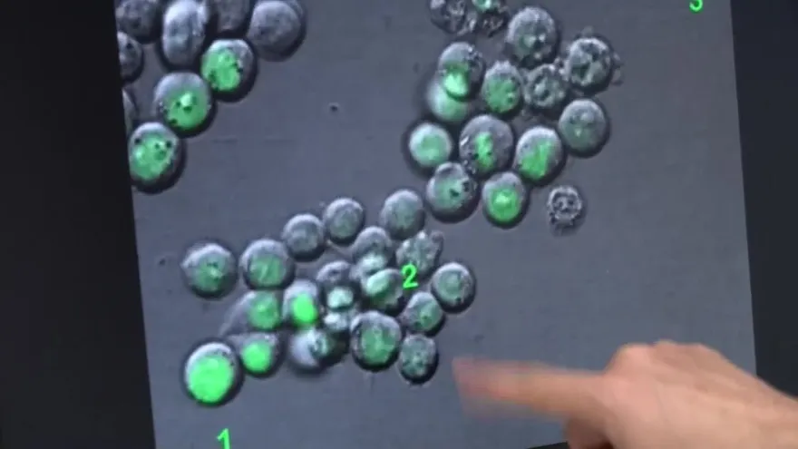 Descubren 'punto débil' de las células tumorales causantes de recaídas del cáncer