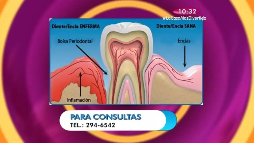 Salud Dental - Hablaremos de la importancia de la salud dental durante el embarazo