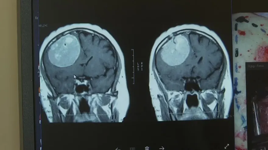 Abogado de Noriega habla sobre la cirugía
