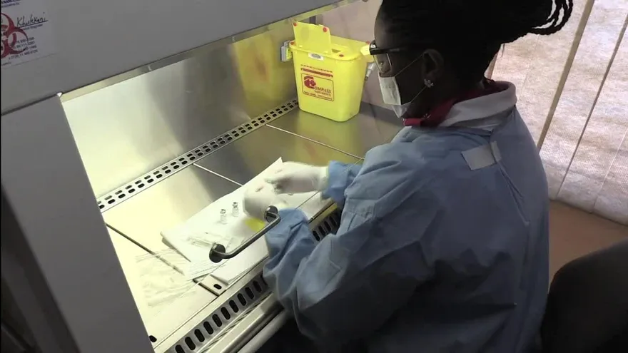 Segundo caso mundial de remisión del virus del sida en paciente