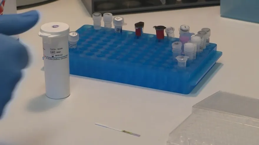 Científicos peruanos buscan producir en masa un test rápido de covid-19