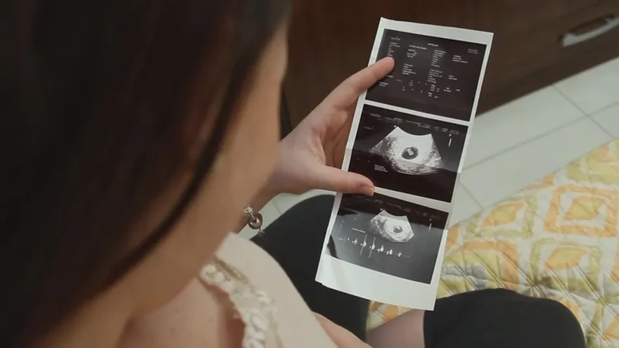 Hicimos ultrasonido en vivo, ¡lo que debes saber de tu bebé no nacido!