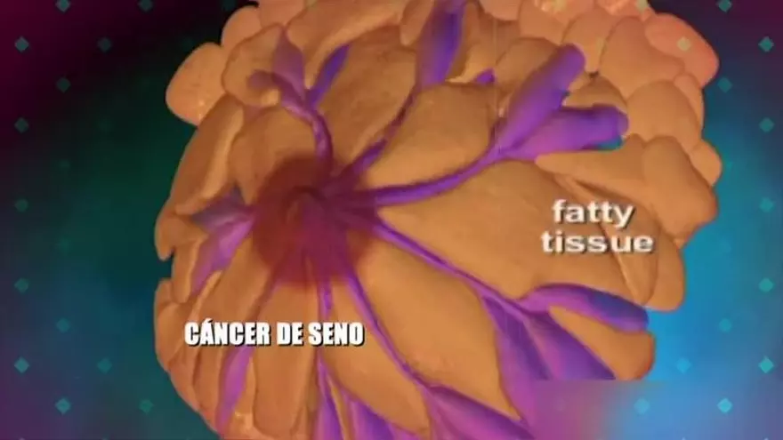 Los factores de riesgo del cáncer