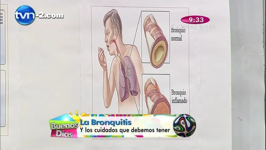 Salud al día - Bronquitis y los cuidados que debemos tener