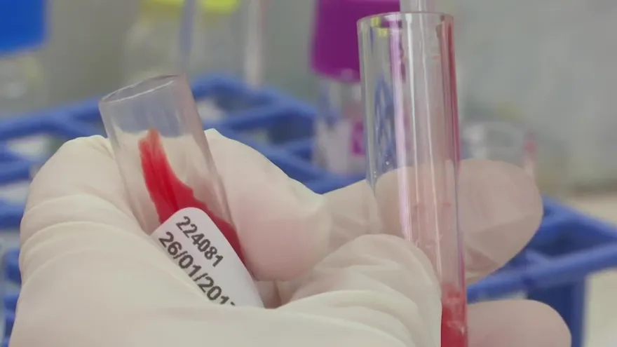 Faltan donantes de sangre en el Hospital del Niño