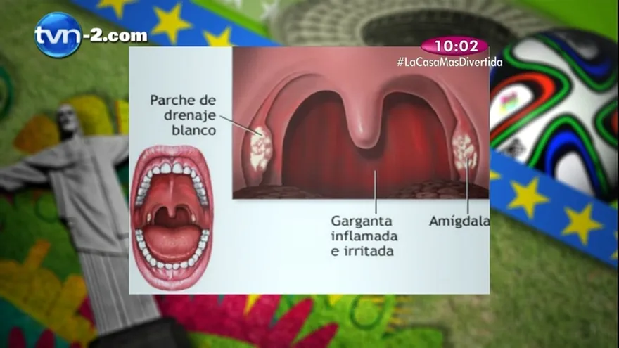 Segmento Madres al Rescate - ¿Cómo tratar el dolor de garganta en los niños?
