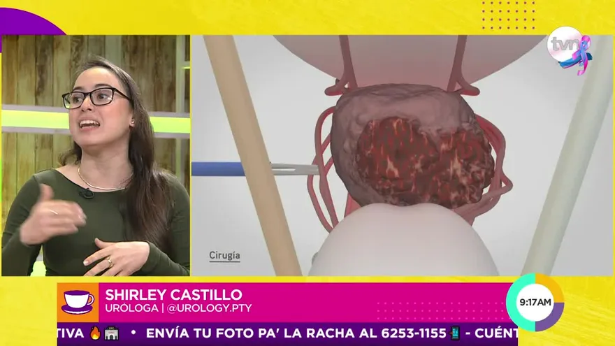 Cáncer de Próstata: Detectalo a tiempo