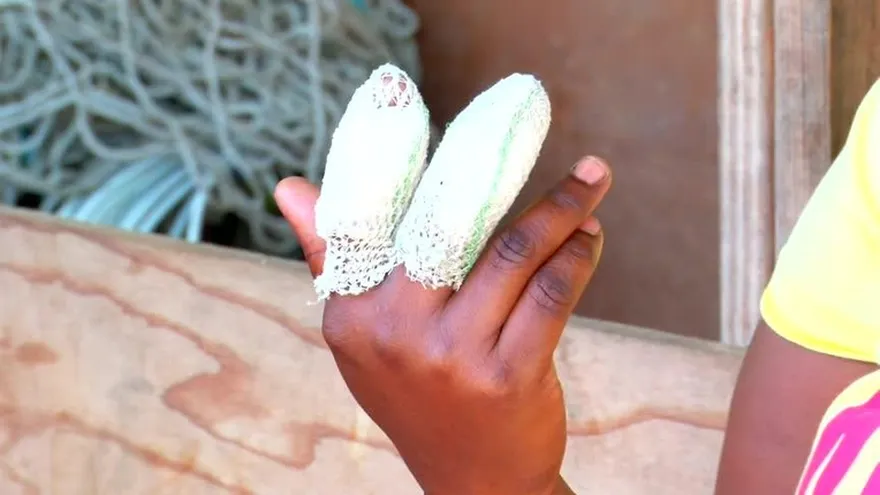 Heridos por protesta en Kuna Nega