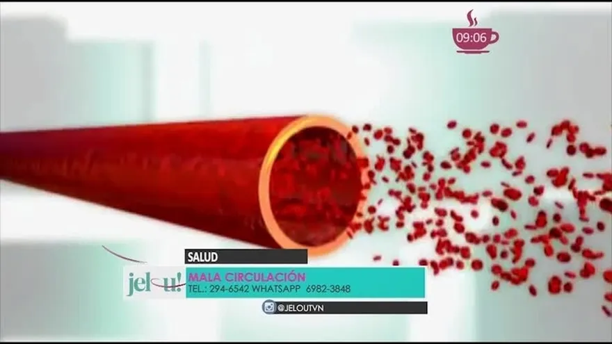 ¿Qué es la Insuficiencia Venosa? Conoce más de este tema aquí