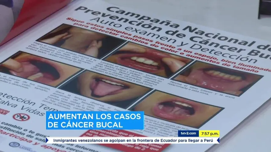 Odontólogos reportan aumento en casos de cáncer bucal