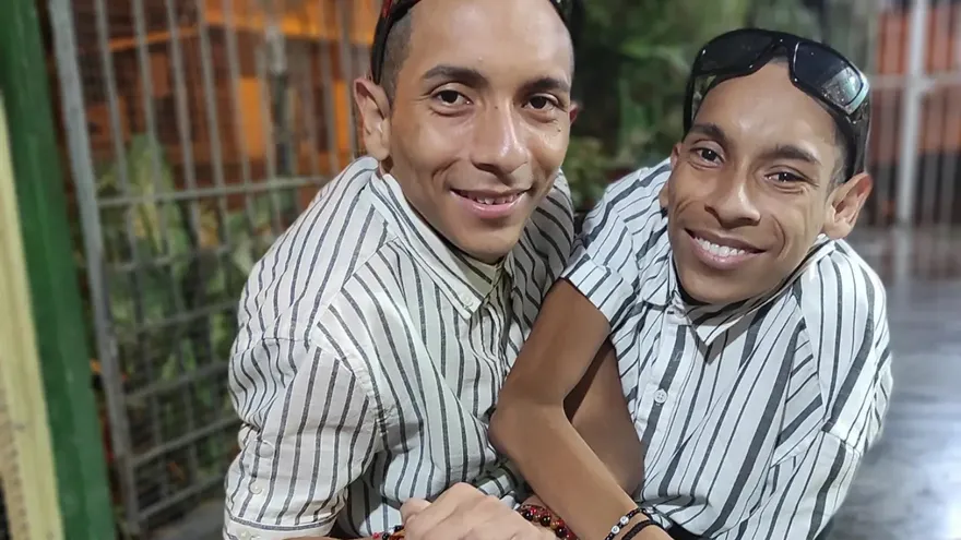 Los siameses del Ecuador
