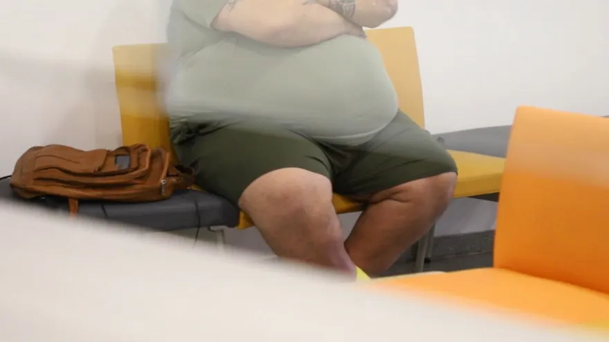 CSS cuenta con Clínica de Obesidad en Ciudad de la Salud para casos severos