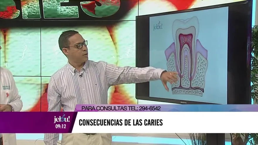 ¿Por qué salen las caries y cuáles son sus consecuencia?