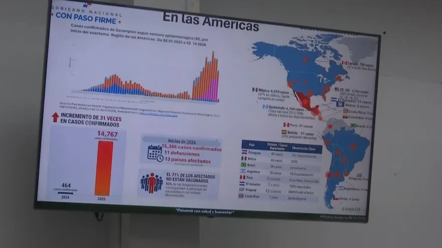 Detectan dos casos importados de sarampión