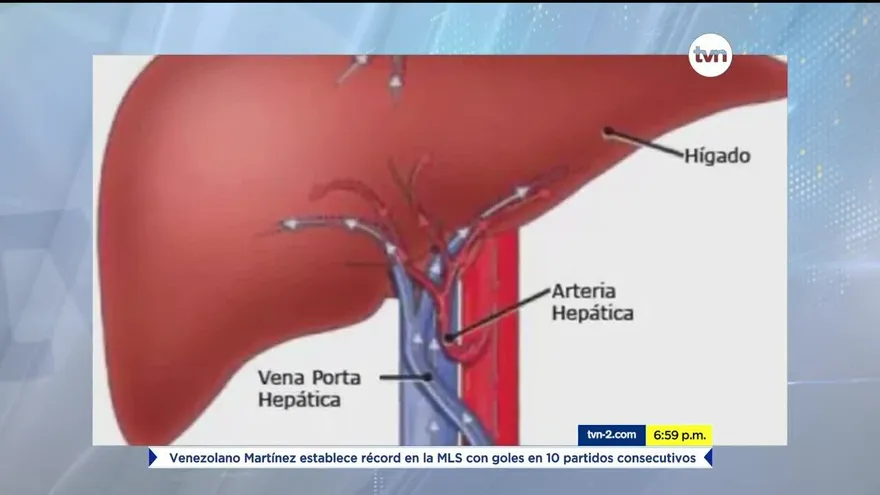 Expertos dan recomendaciones para combatir el cáncer de hígado