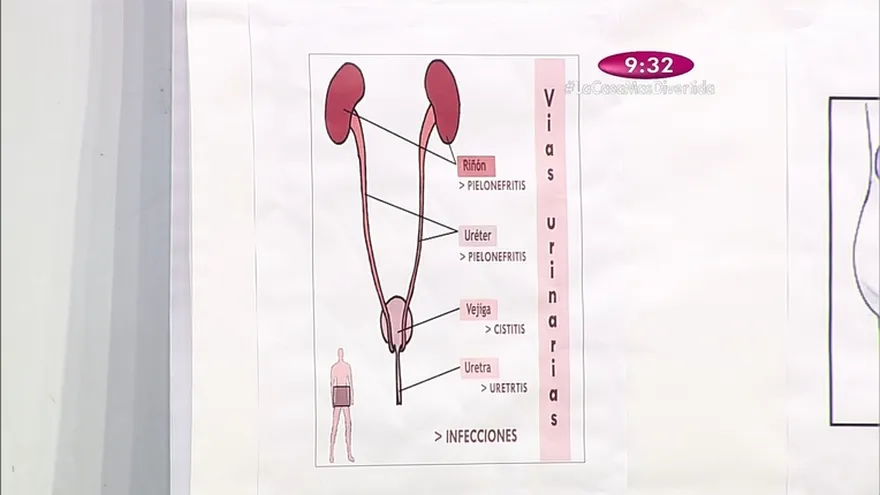 Segmento Salud al Día - Infecciones Urinarias