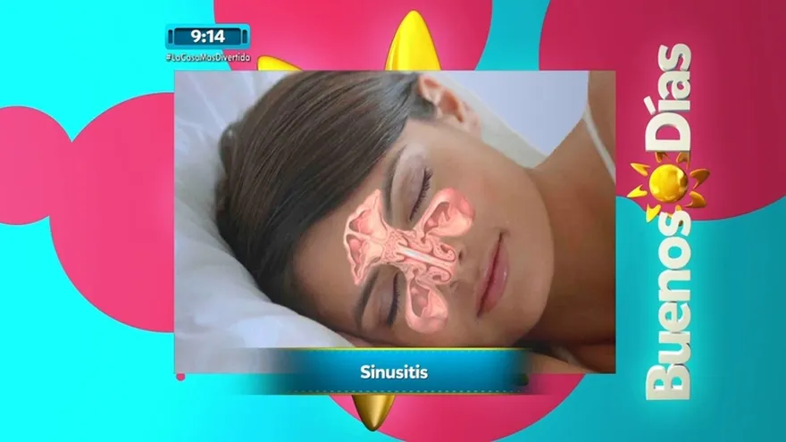 Secreción nasal constante, sufres de dolor de cabeza?