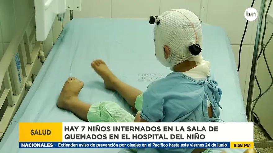 ¿Cómo está actualmente la sala de quemados del Hospital del Niño?