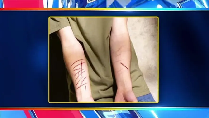 Especialistas piden cautela por casos de jóvenes que se cortan