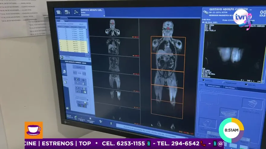 Primero es tu salud: Escaneo corporal completo basado en resonancia magnética