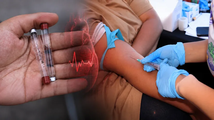 Cardiovascular diseases increase risk of death from dengue, flu, COVID-19, Panama health ministry warns