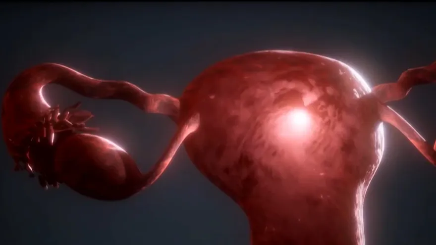 Mujeres indígenas más propensas a cáncer de ovario