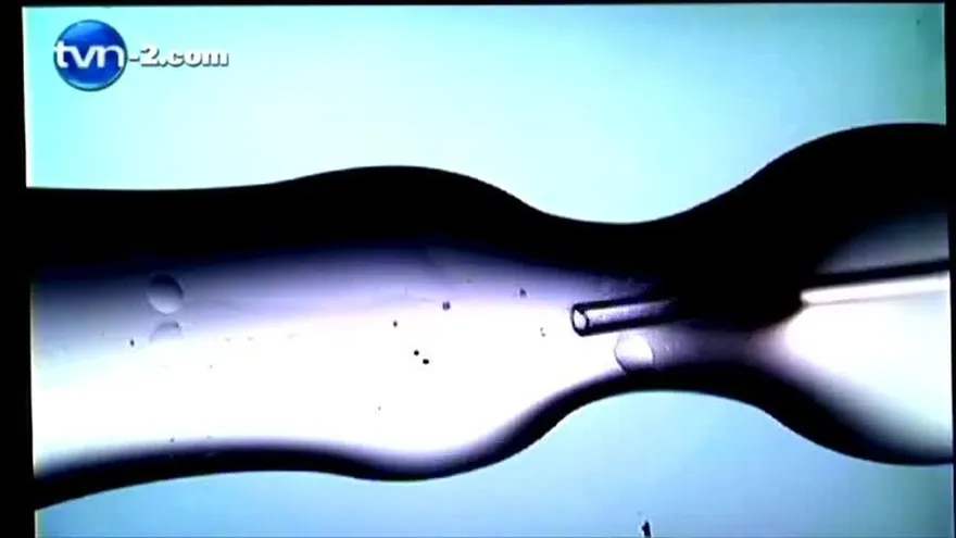 FERTILIZACIÓN  IN VITRO