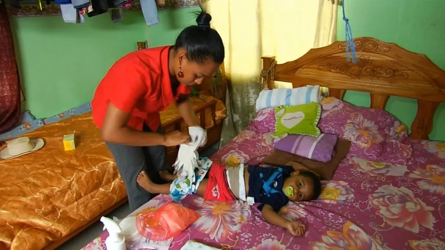 El síndrome Hirschsprung