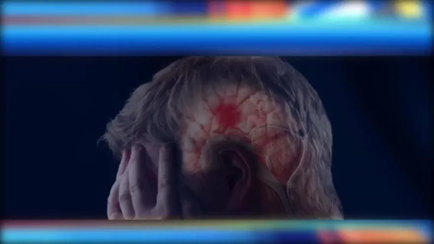 Alerta ante el aumento de personas jóvenes sufriendo derrame cerebral