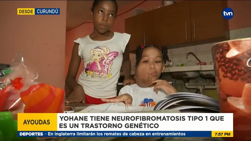 Conozca a Joaneth Castillo, una pequeña con rara enfermedad que pide tu ayuda