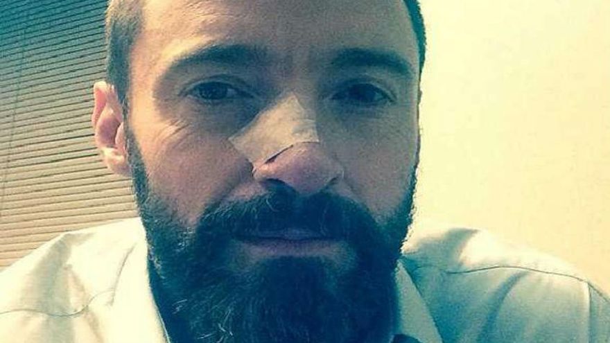Hugh Jackman espera más embates de cáncer de piel