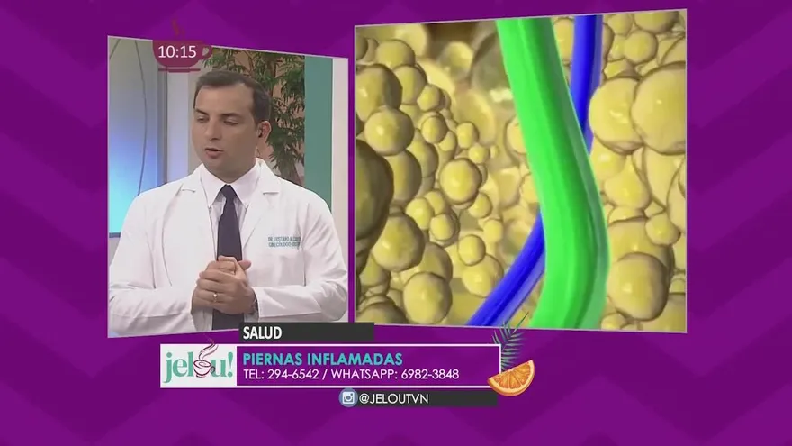 Cómo combatir la hinchazón y dolor en las piernas, ¿mala circulación?